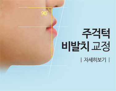 주걱턱 비발치 교정 자세히 보기